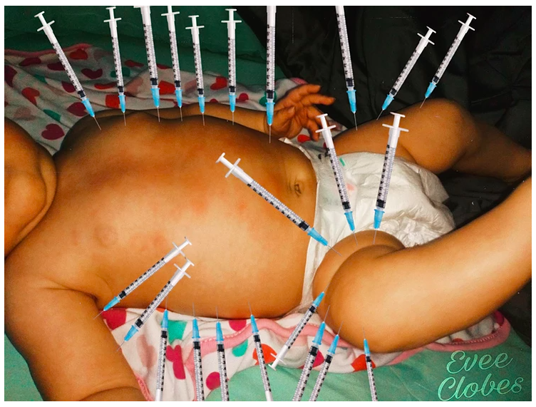 Evee Clobes picture with 23 syringes showing how many vaccines she received.
